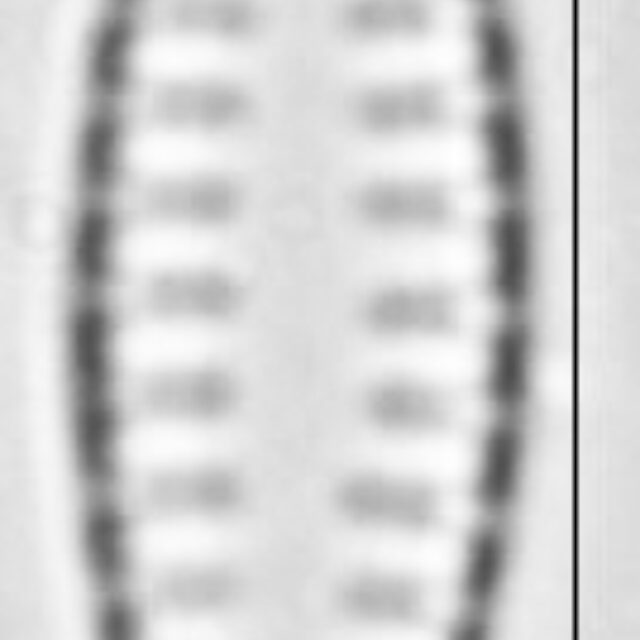 Pseudostaurosira neoelliptica LM5