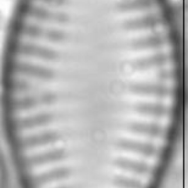 Pseudostaurosira parasitica LM5