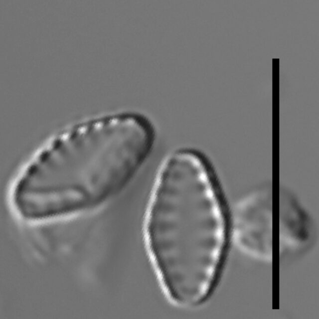 Pseudostaurosiropsis geocollegarum2 ILL L1433