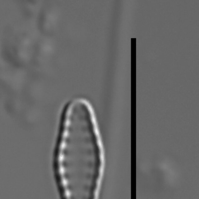 Pseudostaurosiropsis geocollegarum5 ILL L1433