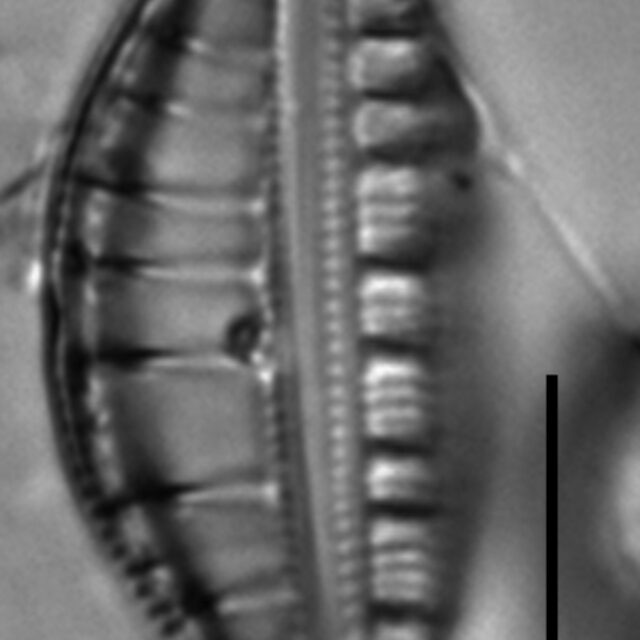 Rhopalodia gibberula LM7