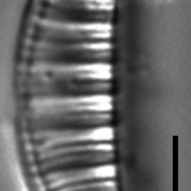 Rhopalodia gibberula LM6