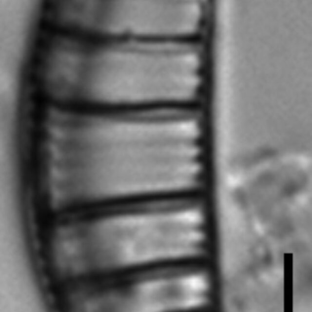 Rhopalodia gibberula LM5