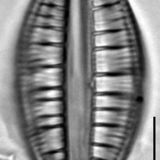 Rhopalodia gibberula LM10