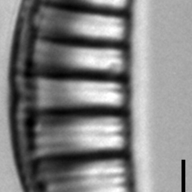 Rhopalodia gibberula LM9