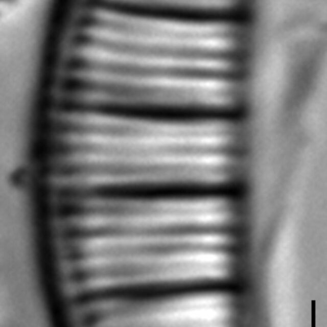 Rhopalodia gibberula LM8