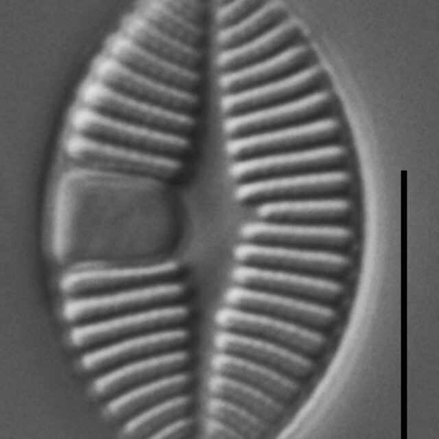 Skabitschewskia oestrupii LM2