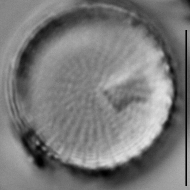 Stephanodiscus binderanus LM5