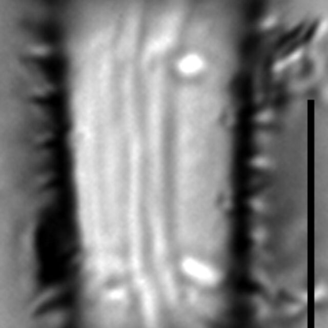 Stephanodiscus hantzschii f tenuis LM1