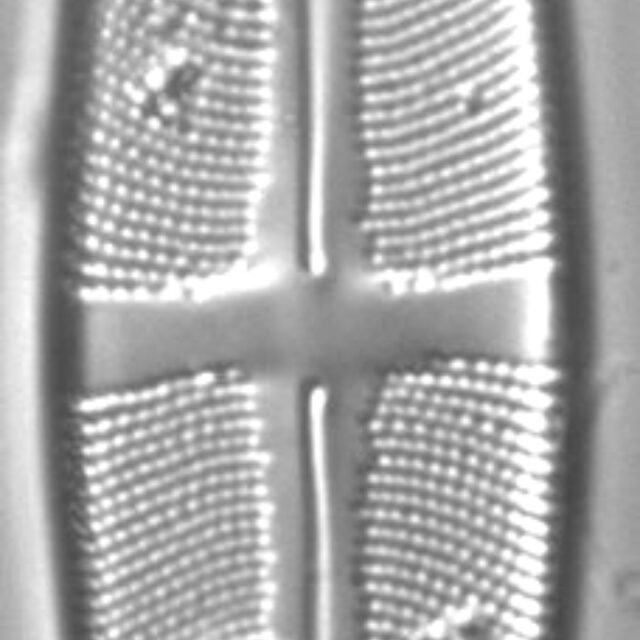 Stauroneis anceps LM7