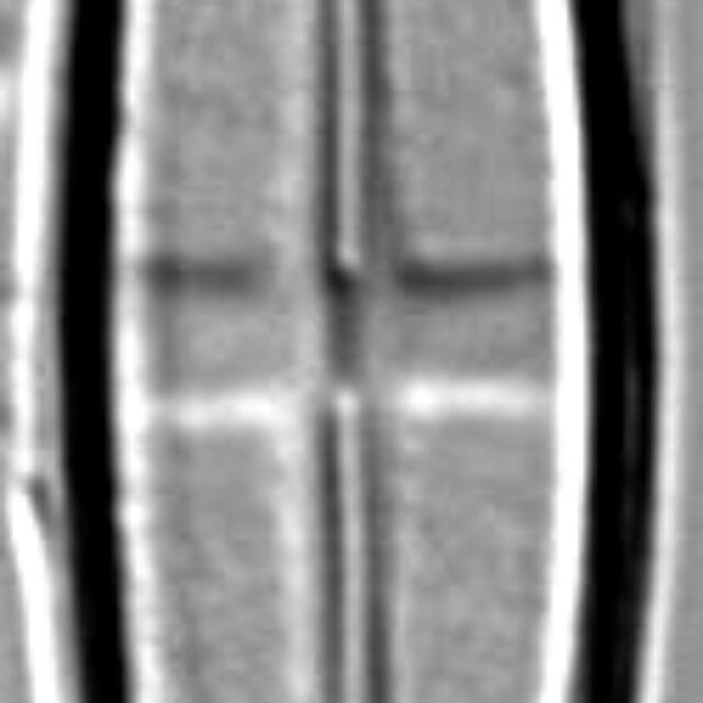 Stauroneis neohyalina LM4