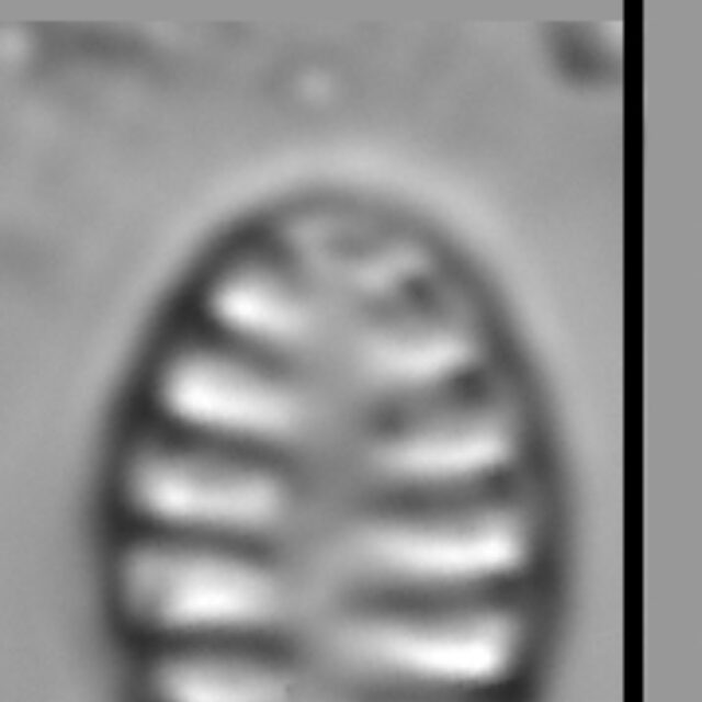 Staurosirella neopinnata LM7