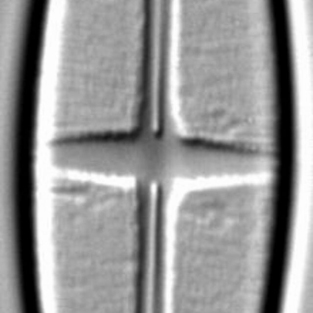 Stauroneis siberica LM4