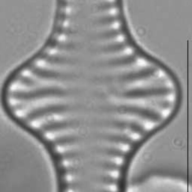 Staurosira construens LM1
