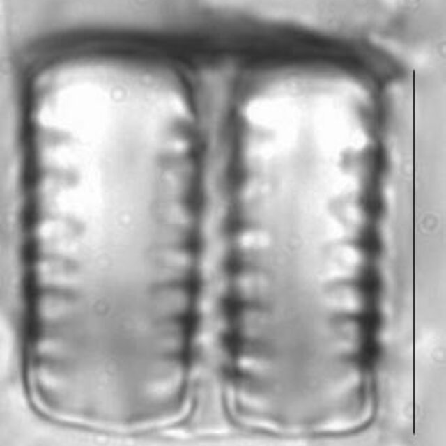 Staurosirella leptostauron LM5