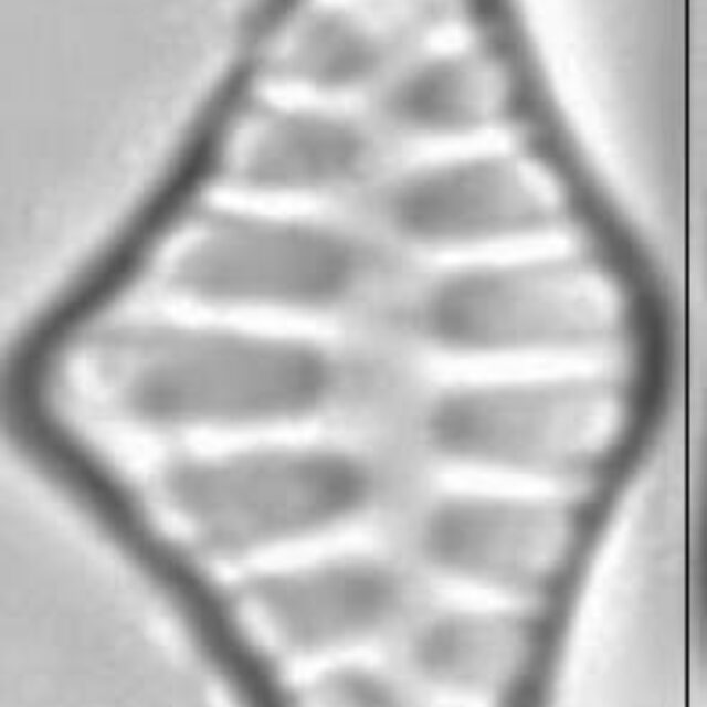 Staurosirella leptostauron LM3