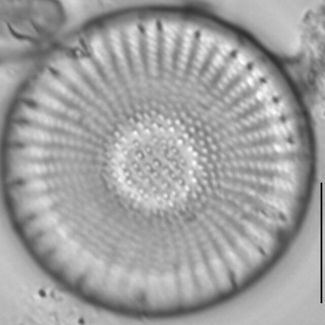 Stephanodiscus medius LM3