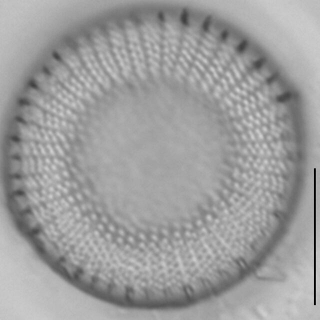 Stephanodiscus medius LM2