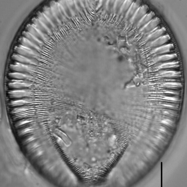 Surirella crumena LM7