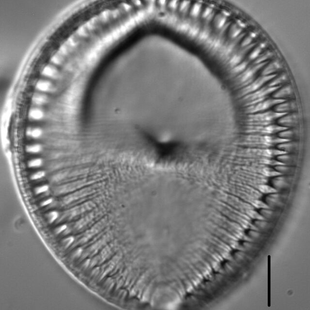 Surirella crumena LM6