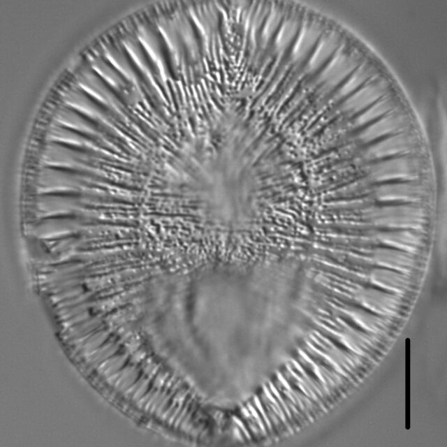 Surirella crumena LM5