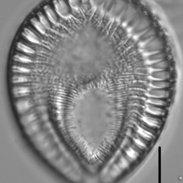 Surirella crumena LM3