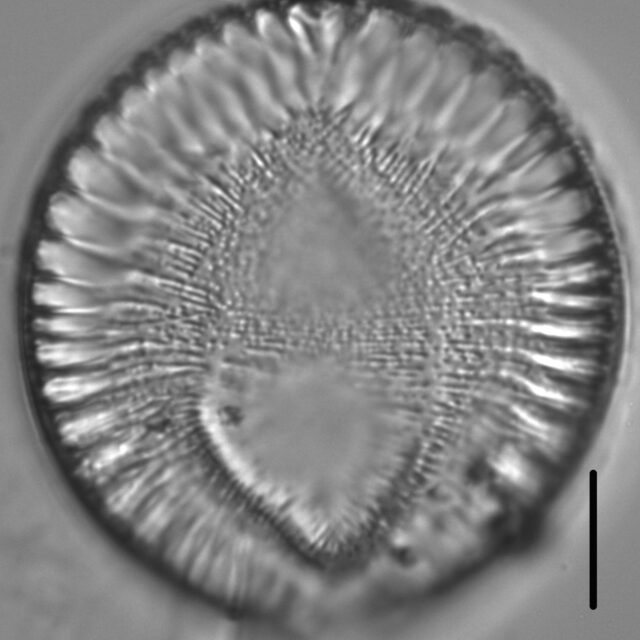 Surirella crumena LM2