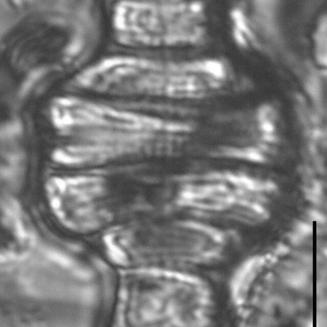 Tetracyclus emarginatus LM5