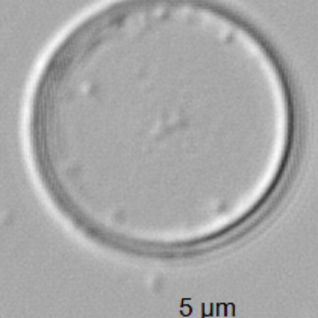 Thalassiosira minima ANSP GC59341 01