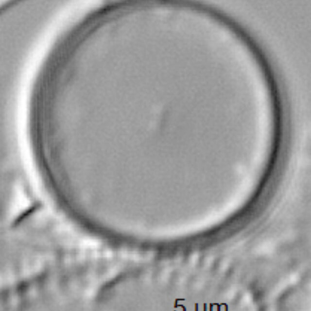 Thalassiosira minima ANSP GC59341 02