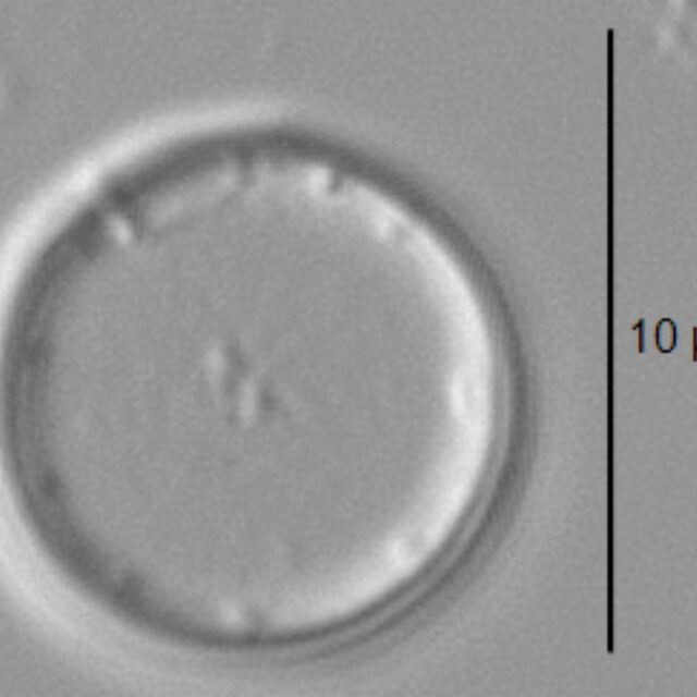 Thalassiosira minima LM2