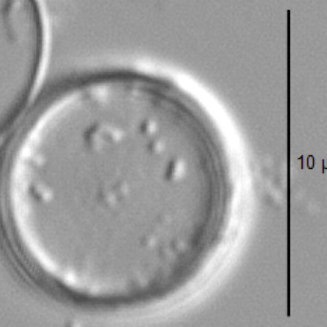 Thalassiosira minima LM3