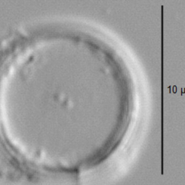 Thalassiosira minima LM5