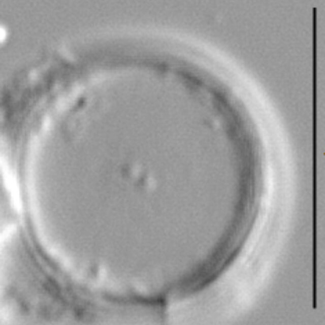 Thalassiosira minima LM4