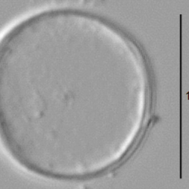 Thalassiosira minima LM6