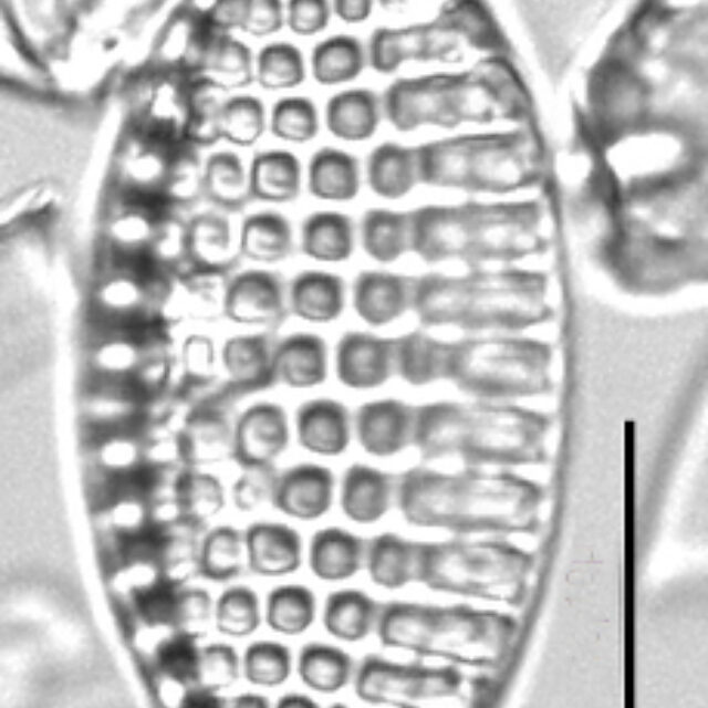 Tryblionella granulata LM5