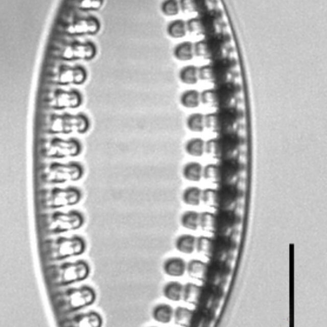 Tryblionella granulata LM2