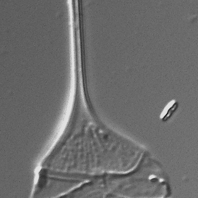 Urosolenia Eriensis Lm16