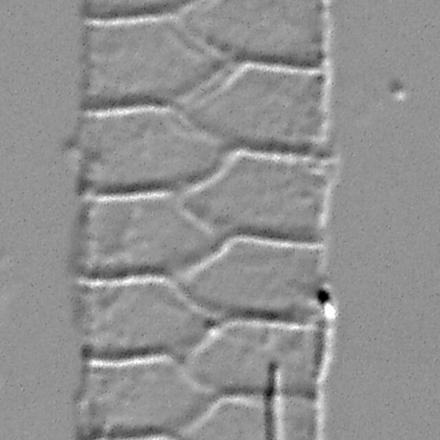 Urosolenia Eriensis Lm3B