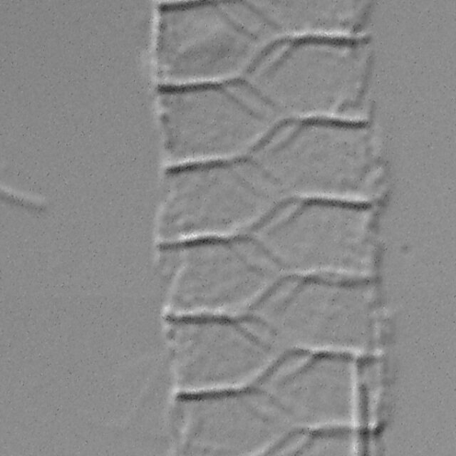 Urosolenia Eriensis Lm3C