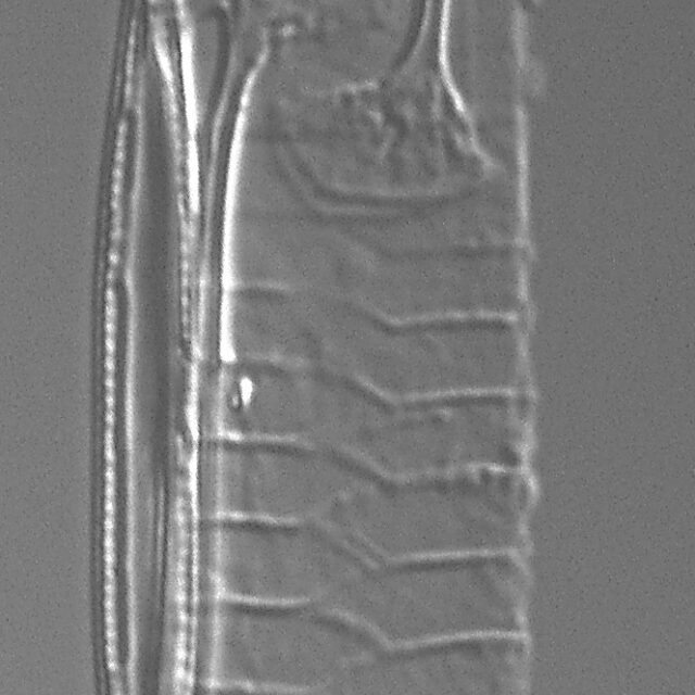 Urosolenia Eriensis Lm7