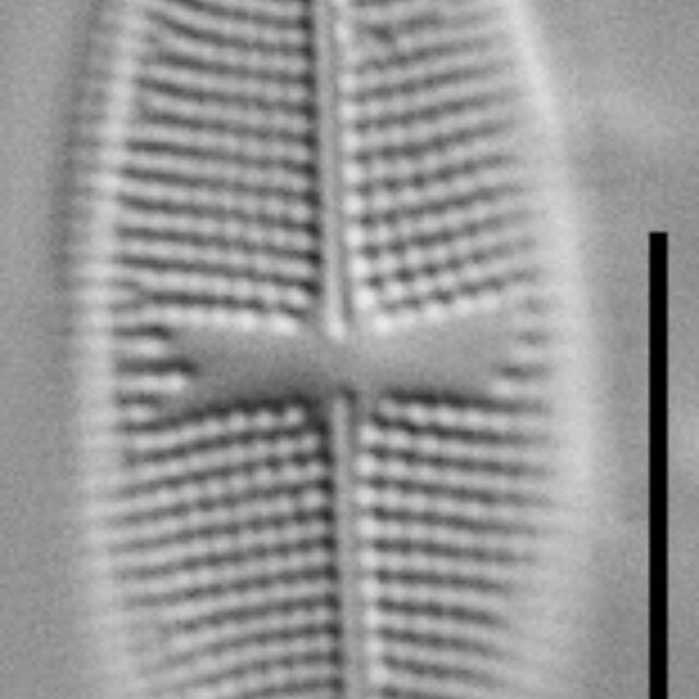 Psammothidium alpinum LM7