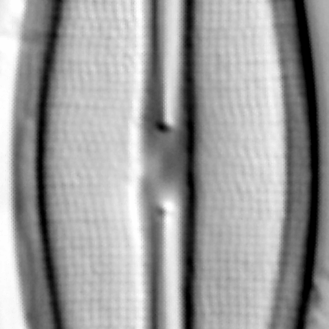 Frustulia crassinverva LM5