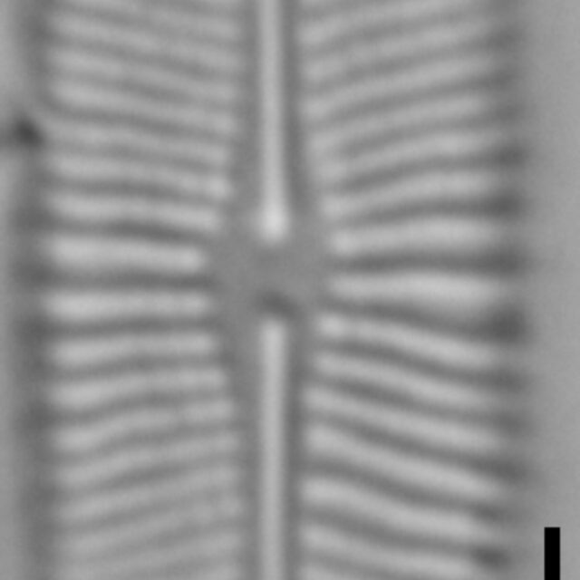 Prestauroneis protracta LM1