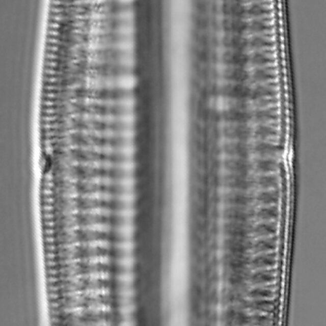 Rhopalodia gibba LM7