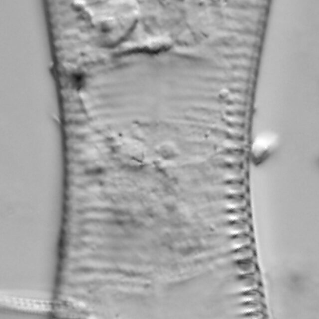 Cymatopleura solea LM3