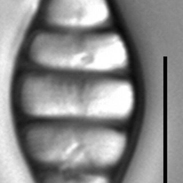 Tetracyclus hinziae LM4