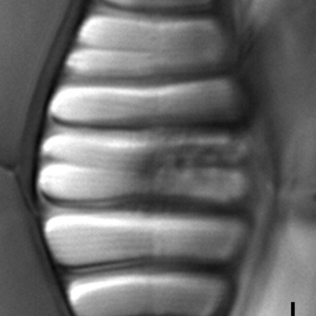 Tetracyclus hinziae LM3