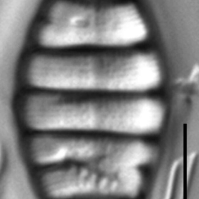 Tetracyclus hinziae LM2