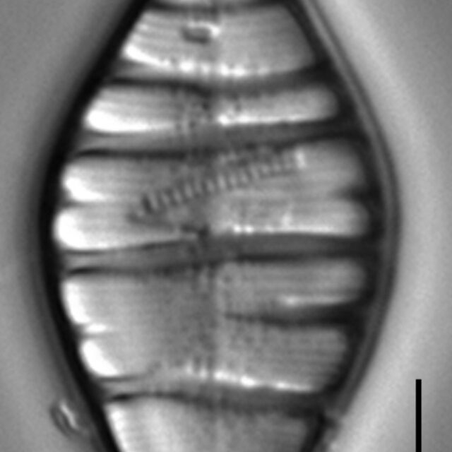 Tetracyclus hinziae LM1